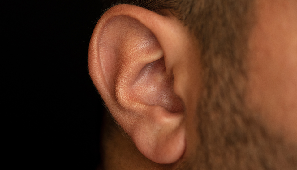 Closeup of an ear for acupuncture therapy